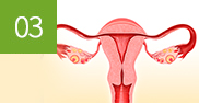 해독 치료 자궁 염증 치료 사진